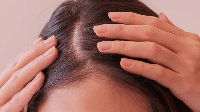 hair_management-image_01